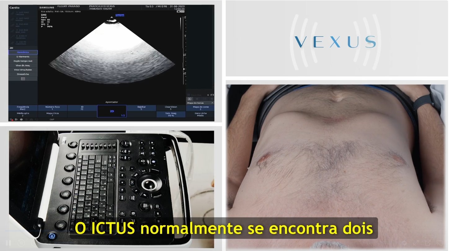 Vídeo prático de janelas ecocardiográficas no modelo vivo